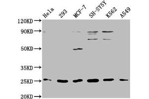 Western Blot Positive WB detected in: Hela whole cell lysate, 293 whole cell lysate, MCF-7 whole cell lysate, SH-SY5Y whole cell lysate, K562 whole cell lysate, A549 whole cell lysate All lanes: ARHGDIG antibody at 1:2000 Secondary Goat polyclonal to rabbit IgG at 1/50000 dilution Predicted band size: 26 kDa Observed band size: 26 kDa