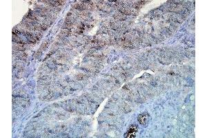 Immunohistochemistry analysis using Mouse Anti-Hsp90 Monoclonal Antibody, Clone D7alpha (ABIN361792 and ABIN361793). (HSP90 antibody)