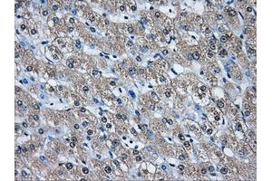 Immunohistochemical staining of paraffin-embedded pancreas tissue using anti-AKR1A1mouse monoclonal antibody. (AKR1A1 antibody)