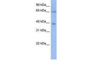 Image no. 1 for anti-Zinc Finger Protein 302 (ZNF302) (N-Term) antibody (ABIN6742848) (ZNF302 antibody  (N-Term))