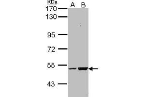 WB Image Sample (30 ug of whole cell lysate) A: Molt-4 , B: Raji 7. (KIAA0494 antibody  (Center))