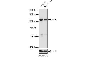 Western blot analysis of extracts of 293T cells, using IGF1R antibody (ABIN3020767, ABIN3020768, ABIN3020769 and ABIN6213714) at 1:3000 dilution. (IGF1R antibody  (AA 660-760))