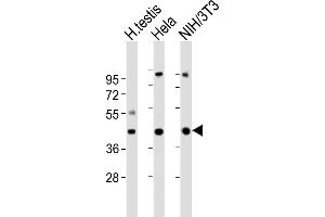 All lanes : Anti-GNA11 Antibody (Center) at 1:2000 dilution Lane 1: human testis lysates Lane 2: Hela whole cell lysates Lane 3: NIH/3T3 whole cell lysates Lysates/proteins at 20 μg per lane. (GNA11 antibody  (AA 115-146))