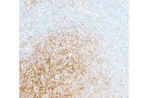 Immunohistochemistry (IHC) image for anti-CD14 (CD14) (AA 20-352) antibody (ABIN7453998)