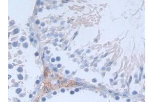 Detection of SDC1 in Rat Testis Tissue using Polyclonal Antibody to Syndecan 1 (SDC1) (Syndecan 1 antibody  (AA 58-313))