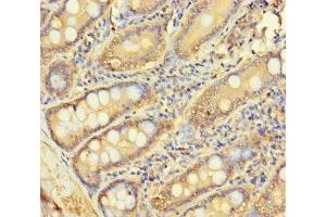 Immunohistochemistry of paraffin-embedded human small intestine tissue using ABIN7158841 at dilution of 1:100 (LOXL3 antibody  (AA 401-608))