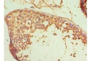 Immunohistochemistry of paraffin-embedded human testis tissue using ABIN7167765 at dilution of 1:100 (ALDH1A1 antibody  (AA 202-501))