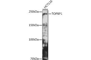 Western blot analysis of extracts of HCT116 cells, using TOPBP1 antibody (ABIN6129493, ABIN6149398, ABIN6149401 and ABIN6221465) at 1:500 dilution. (TOPBP1 antibody  (AA 1253-1522))