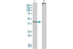 Western Blot analysis of MAGEA2 expression in transfected 293T cell line by MAGEA2 monoclonal antibody (M01), clone 1H4. (MAGEA2 antibody  (AA 1-314))