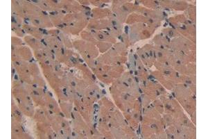 DAB staining on IHC-P; Samples: Mouse Heart Tissue (ATP2B2 antibody  (AA 417-830))
