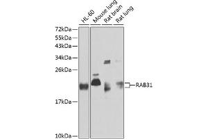 Western blot analysis of extracts of various cell lines, using R antibody (ABIN6128595, ABIN6146569, ABIN6146571 and ABIN6220321) at 1:1000 dilution.