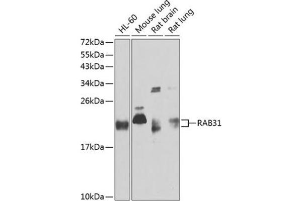 RAB31 antibody  (AA 1-195)