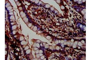 PTPN3 antibody  (AA 365-505)