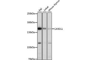 Western blot analysis of extracts of various cell lines, using C antibody (ABIN6127550, ABIN6137939, ABIN6137940 and ABIN6222956) at 1:1000 dilution. (CARD11 antibody  (AA 985-1154))