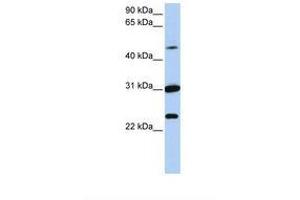 Image no. 1 for anti-Membrane transport protein XK (XK) (AA 72-121) antibody (ABIN6737735) (Membrane transport protein XK (XK) (AA 72-121) antibody)