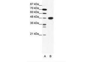 Image no. 1 for anti-Enolase 1 (ENO1) (N-Term) antibody (ABIN202517) (ENO1 antibody  (N-Term))