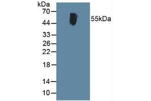 Western blot analysis of Human Blood Cells. (ALT antibody  (AA 367-480))