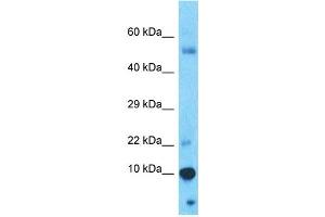 Host:  Rabbit  Target Name:  PAGE4  Sample Type:  Thymus Tumor lysates  Antibody Dilution:  1. (PAGE4 antibody  (N-Term))