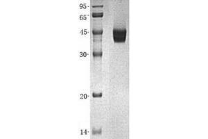 Western Blotting (WB) image for Glutamine Synthetase (GLN1) (Transcript Variant 1) protein (His tag) (ABIN2722013)