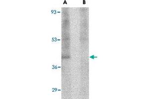 Western blot analysis of RIMS3 in human brain tissue lysate with RIMS3 polyclonal antibody  at 1 ug/mL in the (A) absence and (B) presence of blocking peptide.