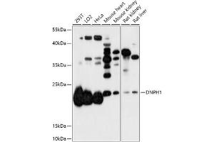 Western blot analysis of extracts of various cell lines, using DNPH1 antibody (ABIN7266384) at 1:1000 dilution. (RCL antibody  (AA 1-174))