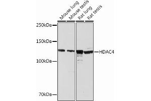 Western blot analysis of extracts of various cell lines, using HD Rabbit mAb (ABIN6132653, ABIN6147718, ABIN6147719 and ABIN7101423) at 1:1000 dilution. (HDAC4 antibody)