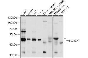Western blot analysis of extracts of various cell lines, using SLC39 antibody (ABIN1682785, ABIN3017729, ABIN3017730 and ABIN6220217) at 1:1000 dilution. (SLC39A7 antibody  (AA 235-380))