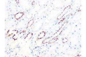 Immunohistochemistry of paraffin-embedded rat kidney using PDHB Rabbit mAb (ABIN7269772) at dilution of 1:100 (40x lens). (PDHB antibody)