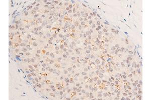 Immunohistochemistry (IHC) image for anti-Tumor Protein P53 (TP53) (acLys319) antibody (ABIN6254862)