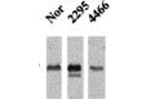 CamKII (22B1), Mice ventricles. (CAMKII gamma antibody)