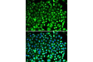 Immunofluorescence analysis of MCF-7 cells using PSMB2 antibody (ABIN6291444). (PSMB2 antibody)