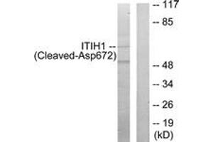 Western blot analysis of extracts from Jurkat cells, treated with etoposide 25uM 24h, using ITIH1 (Cleaved-Asp672) Antibody.