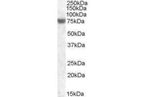 ABIN2562572 (1µg/ml) staining of Human Heart lysate (35µg protein in RIPA buffer).