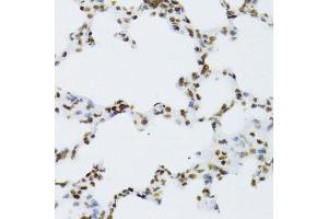 Immunohistochemistry (Paraffin-embedded Sections) (IHC (p)) image for anti-Nuclear Factor of kappa Light Polypeptide Gene Enhancer in B-Cells 2 (NFKB2) (AA 690-899) antibody (ABIN3017388)