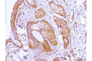 IHC analysis of HOXC12 using anti-HOXC12 antibody (ABIN7599065).
