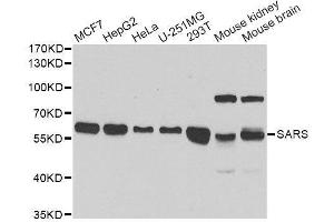 Western blot analysis of extracts of various cell lines, using SARS antibody. (Seryl-tRNA Synthetase (SARS) (AA 1-300) antibody)