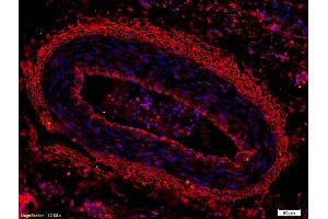 Formalin-fixed and paraffin embedded rat liver labeled with Anti-CK18 Polyclonal Antibody, Unconjugated (ABIN676973) at 1:800, followed by conjugation to the secondary antibody and DAB staining. (Cytokeratin 18 antibody  (AA 53-150))