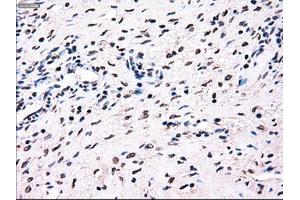 Immunohistochemical staining of paraffin-embedded colon tissue using anti-BRAFmouse monoclonal antibody.