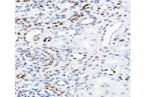 ABIN6266610 at 1/100 staining human kidney tissue sections by IHC-P. (KAT2B antibody  (C-Term))