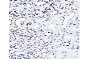 ABIN6266610 at 1/100 staining human kidney tissue sections by IHC-P. (KAT2B antibody  (C-Term))
