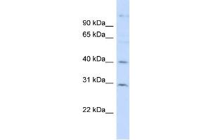 WB Suggested Anti-FAM50B Antibody Titration: 0. (FAM50B antibody  (N-Term))