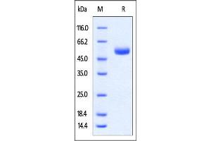 Rabbit CTLA-4 Protein, Fc Tag on SDS-PAGE under reducing (R) condition.