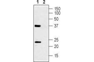 Western blot analysis of rat skeletal muscle lysate: - 1. (CACNG1 antibody  (1st Extracellular Loop))