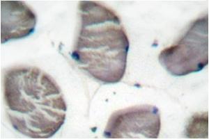 Image no. 1 for anti-Actin, alpha 1, Skeletal Muscle (ACTA1) antibody (ABIN265299) (Actin antibody)