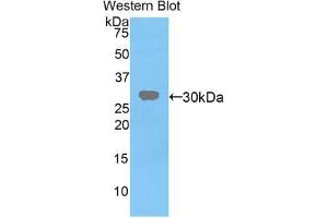 Western blot analysis of the recombinant protein. (VRK1 antibody  (AA 46-292))