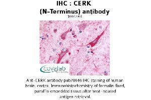 Image no. 1 for anti-Ceramide Kinase (CERK) (Extracellular Domain), (N-Term) antibody (ABIN1733020) (CERK antibody  (Extracellular Domain, N-Term))