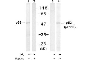 Image no. 1 for anti-Tumor Protein P53 (TP53) (Thr18) antibody (ABIN319303) (p53 antibody  (Thr18))