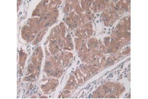 DAB staining on IHC-P Samples:Human Stomach Tissue) (PAI1 antibody  (AA 25-402))
