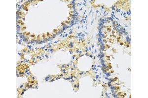 Immunohistochemistry of paraffin-embedded Rat lung using HRG Polyclonal Antibody at dilution of 1:100 (40x lens). (HRG antibody)