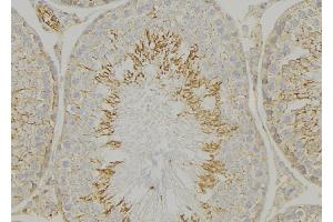 ABIN6269155 at 1/100 staining Mouse testis tissue by IHC-P. (VAV1 antibody  (N-Term))